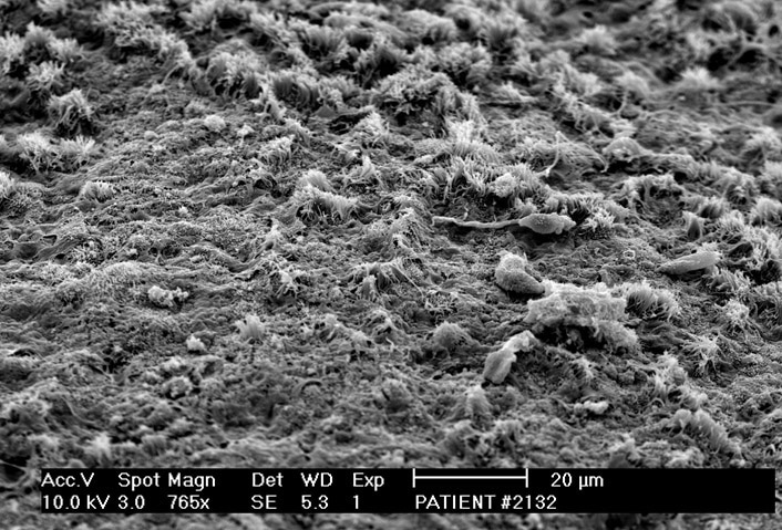Cilia in poor shape